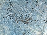 CSF2RB Antibody in Immunohistochemistry (Paraffin) (IHC (P))