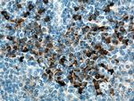 CSF2RB Antibody in Immunohistochemistry (Paraffin) (IHC (P))