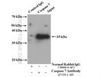 Caspase 7 Antibody in Immunoprecipitation (IP)