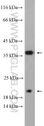 Caspase 7 Antibody in Western Blot (WB)