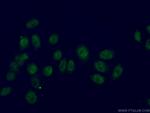 ATM Antibody in Immunocytochemistry (ICC/IF)