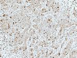 ATM Antibody in Immunohistochemistry (Paraffin) (IHC (P))