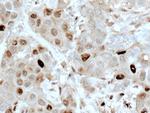 ATM Antibody in Immunohistochemistry (Paraffin) (IHC (P))