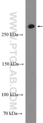 ATM Antibody in Western Blot (WB)