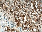 PLCG2 Antibody in Immunohistochemistry (Paraffin) (IHC (P))