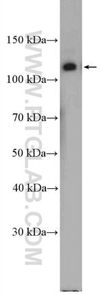 Integrin alpha-6 Antibody in Western Blot (WB)