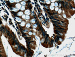 Integrin alpha-6 Antibody in Immunohistochemistry (Paraffin) (IHC (P))