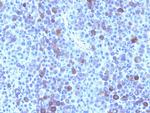 Glypican-3 (GPC3) (Hepatocellular Carcinoma Marker) Antibody in Immunohistochemistry (Paraffin) (IHC (P))