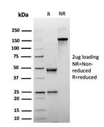 Glypican-3 (GPC3) Antibody in SDS-PAGE (SDS-PAGE)