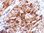 Glypican-3 (GPC3) Antibody in Immunohistochemistry (Paraffin) (IHC (P))