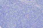 Glypican-3 (GPC3) (Hepatocellular Carcinoma Marker) Antibody in Immunohistochemistry (Paraffin) (IHC (P))