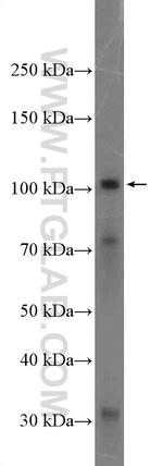 NHE3 Antibody in Western Blot (WB)