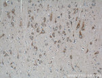 Huntingtin Antibody in Immunohistochemistry (Paraffin) (IHC (P))