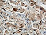 BDH2 Antibody in Immunohistochemistry (Paraffin) (IHC (P))