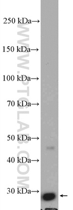 BDH2 Antibody in Western Blot (WB)