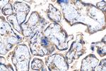 TGFBR2 Antibody in Immunohistochemistry (Paraffin) (IHC (P))