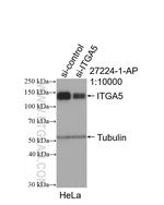 ITGA5 Antibody in Western Blot (WB)