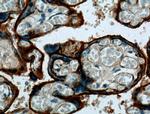 ITGA5 Antibody in Immunohistochemistry (Paraffin) (IHC (P))