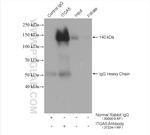 ITGA5 Antibody in Immunoprecipitation (IP)