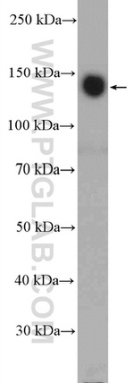 ITGA5 Antibody in Western Blot (WB)