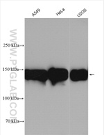 ITGA5 Antibody in Western Blot (WB)