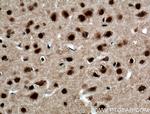 FTO Antibody in Immunohistochemistry (Paraffin) (IHC (P))