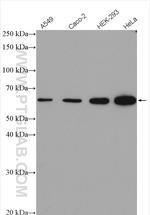 FTO Antibody in Western Blot (WB)