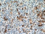 IFI44 Antibody in Immunohistochemistry (Paraffin) (IHC (P))