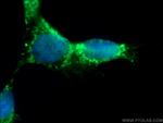 RICTOR Antibody in Immunocytochemistry (ICC/IF)