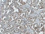 RICTOR Antibody in Immunohistochemistry (Paraffin) (IHC (P))