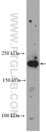 RICTOR Antibody in Western Blot (WB)