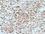 Neurofibromin Antibody in Immunohistochemistry (Paraffin) (IHC (P))