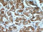 Neurofibromin Antibody in Immunohistochemistry (Paraffin) (IHC (P))