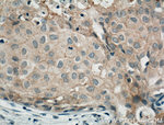 Occludin Antibody in Immunohistochemistry (Paraffin) (IHC (P))