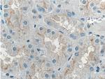 Occludin Antibody in Immunohistochemistry (Paraffin) (IHC (P))