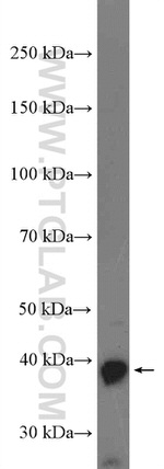 GNAQ Antibody in Western Blot (WB)