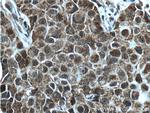 KMT2D Antibody in Immunohistochemistry (Paraffin) (IHC (P))