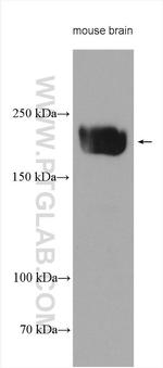 KIF20B Antibody in Western Blot (WB)