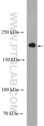 KIF21A Antibody in Western Blot (WB)