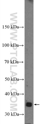 KCTD10 Antibody in Western Blot (WB)