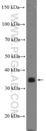 KCTD10 Antibody in Western Blot (WB)