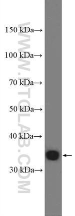 KCTD10 Antibody in Western Blot (WB)