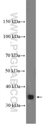 KCTD10 Antibody in Western Blot (WB)