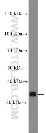 KCTD10 Antibody in Western Blot (WB)