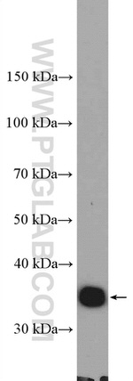 KCTD10 Antibody in Western Blot (WB)