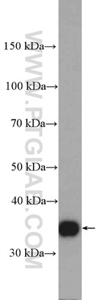 KCTD10 Antibody in Western Blot (WB)