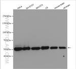 Calreticulin Antibody in Western Blot (WB)