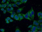 Calreticulin Antibody in Immunocytochemistry (ICC/IF)