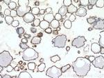 Calreticulin Antibody in Immunohistochemistry (Paraffin) (IHC (P))