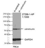 Calreticulin Antibody in Western Blot (WB)